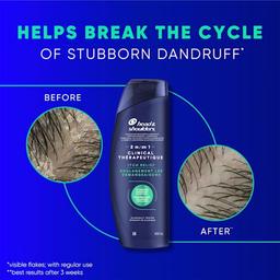 Product thumb gallery 65128438